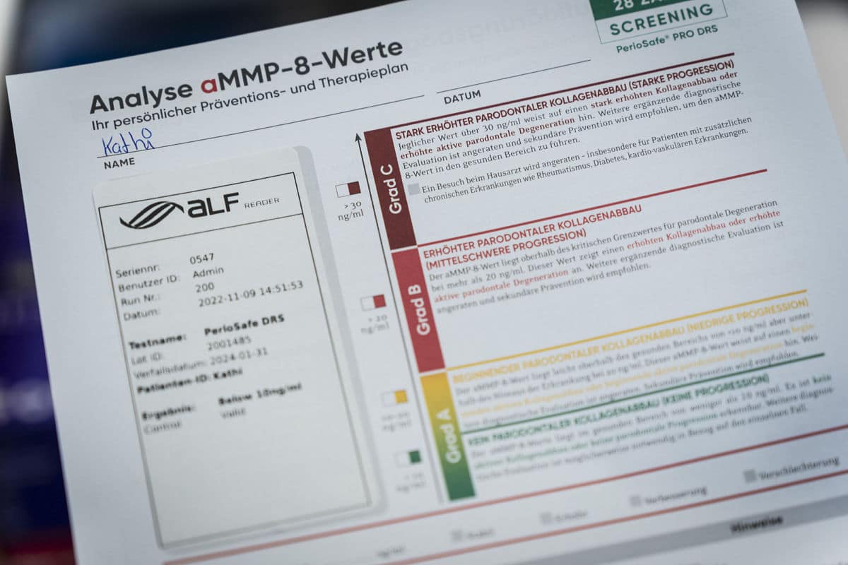 Analyse im Implant Safe Center: Diagnostik für gesunde Zahnimplantate