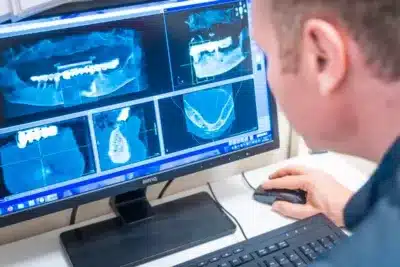 DVT Auswertung, Röntgen in 3D beim Zahnarzt Köln